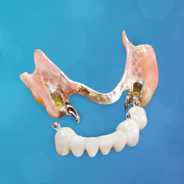 potesis-dental-hibrida-italprodent