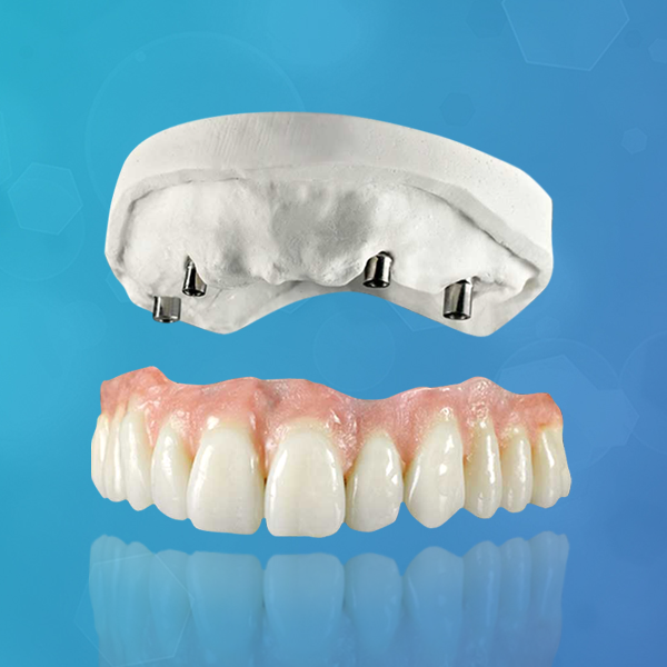 protesis-dental-sobre-implante-sobredentadura-italprodent