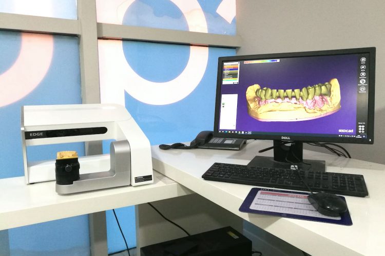 tecnologia-cad-cam-escaner-laboratorio-dental-italprodent-tenerife